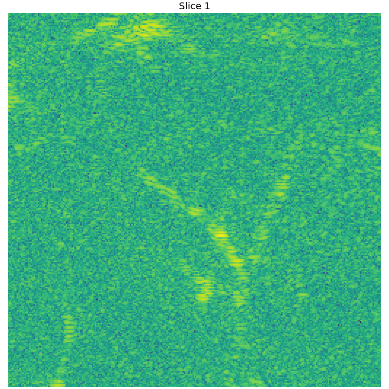 Reconstruction with 25:60 Singular Values